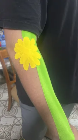 Kinesiotape aangebracht op een onderarm, van dichtbij
